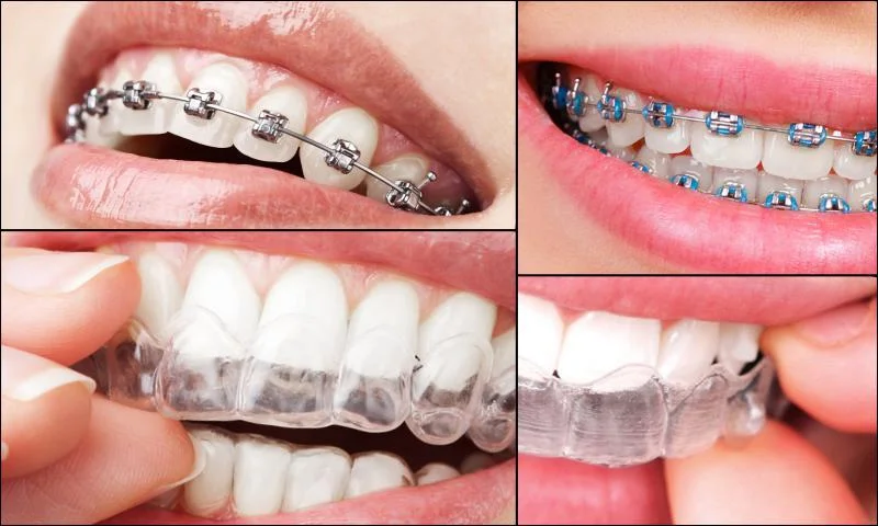 Ağız Diş ve Çene Cerrahisi Nasıl Yapılır?