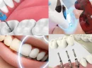 Düzce Özel Diş Klinikleri Nasıl Çalışır?