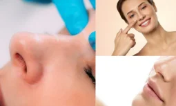 Kapalı Burun Estetiği ile Açık Teknik Arasındaki Fark Nedir?