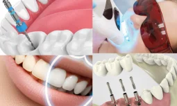 Düzce Özel Diş Klinikleri Nasıl Çalışır?