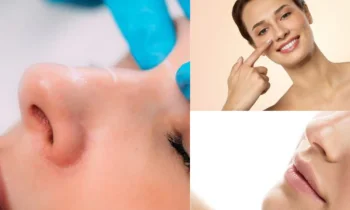 Kapalı Burun Estetiği ile Açık Teknik Arasındaki Fark Nedir?