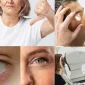 Katarakt Nedir ve Tedavisi Var Mıdır?